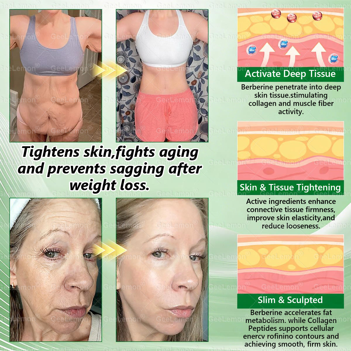 𝐆𝐞𝐞𝐋𝐞𝐦𝐨𝐧® 𝐌𝐨𝐫𝐢𝗻𝗴𝗮 · 𝐁𝐞𝐫𝐛𝗲𝗿𝗶𝗻𝗲 × 𝗡𝗔𝗗+ 𝟏𝟎 𝐢𝐧 𝟏 𝐀𝐝𝐯𝐚𝐧𝐜𝐞𝐝 𝗡𝗮𝗻𝗼 𝗠𝗶𝗰𝗿𝗼𝗻𝐞𝐞𝐝𝐥𝐞 𝐏𝐚𝐭𝗰𝗵 👩‍⚕️(Just once a day, visible changes in 7 days) For obesity, cardiovascular health, diabetes, sleep apnea, thyroid gland, intestinal health, joint problems and more