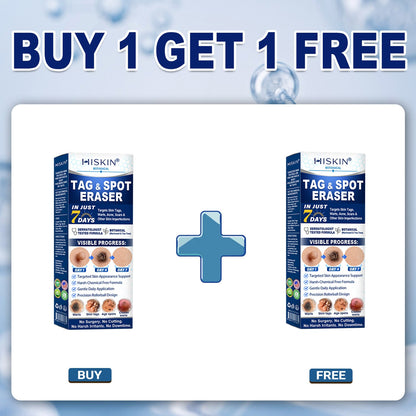 𝐇𝐈𝐒𝐊𝐈𝐍®👩‍⚕️😍𝟕-𝐃𝒂𝘆 𝐒𝗸𝐢𝐧 𝐓𝒂𝗴 & 𝐒𝐩𝙤𝐭 𝐄𝐫𝒂𝐬𝙚𝐫 Painless & Scar-Free Advanced Imperfection Removal Rollerball Pen