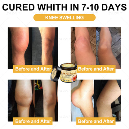 ZVLZVL™ Bee Venom Instant Pain Relief Arthritis Therapy Cream