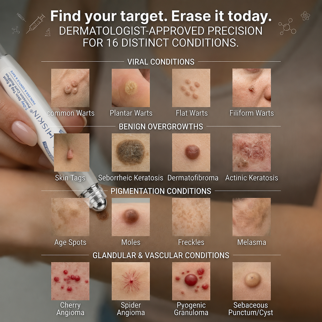 𝐇𝐈𝐒𝐊𝐈𝐍®👩‍⚕️😍𝟕-𝐃𝒂𝘆 𝐒𝗸𝐢𝐧 𝐓𝒂𝗴 & 𝐒𝐩𝙤𝐭 𝐄𝐫𝒂𝐬𝙚𝐫 Painless & Scar-Free Advanced Imperfection Removal Rollerball Pen