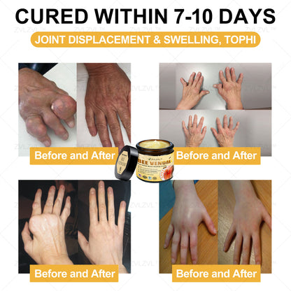 ZVLZVL™ Bee Venom Instant Pain Relief Arthritis Therapy Cream