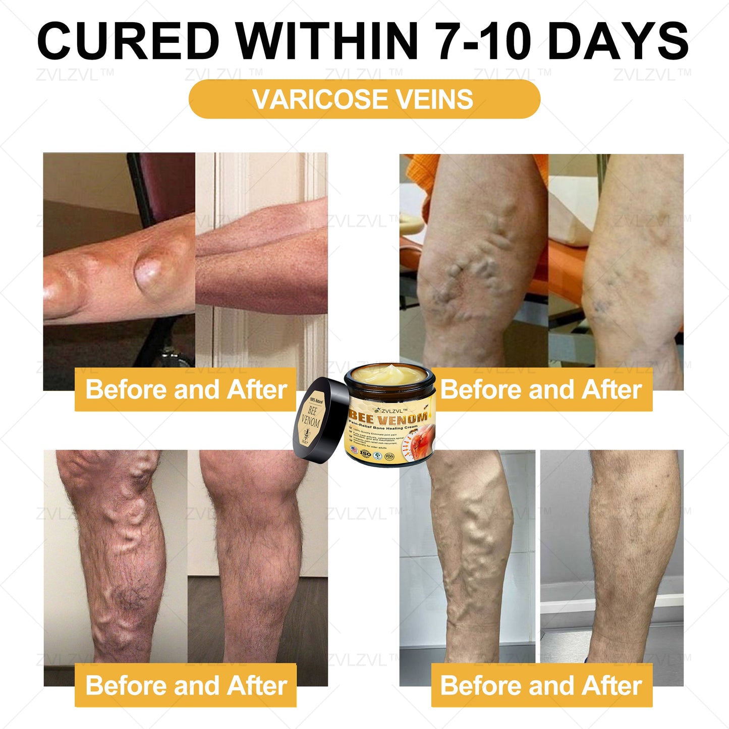 ZVLZVL™ Bee Venom Instant Pain Relief Arthritis Therapy Cream
